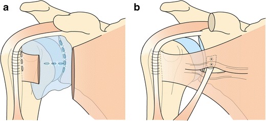 Fig. 14