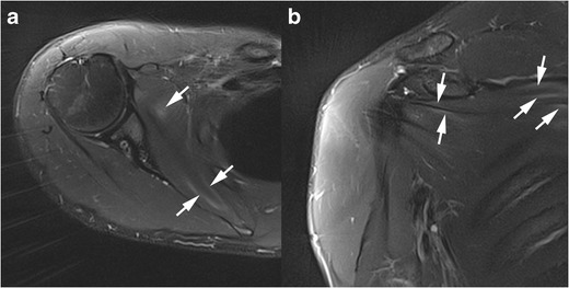 Fig. 16