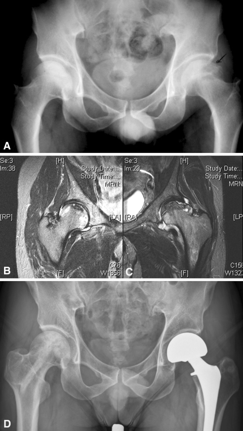 Fig. 1A–D