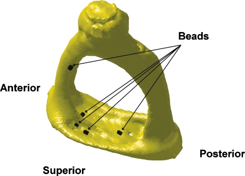 FIG. 1