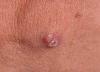 Fig. 9