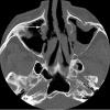 Fig. 13
