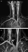 Fig. 11