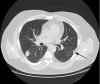 Fig. 14