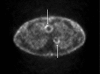 Fig. 12