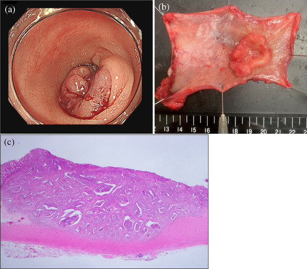 FIGURE 3