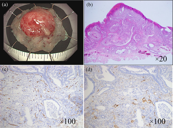 FIGURE 2