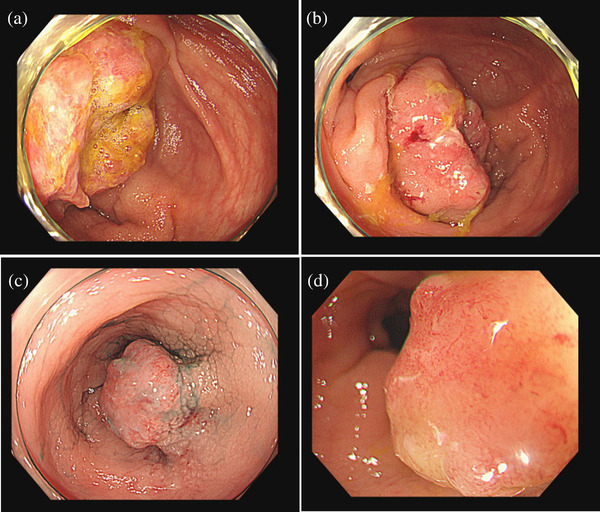 FIGURE 1