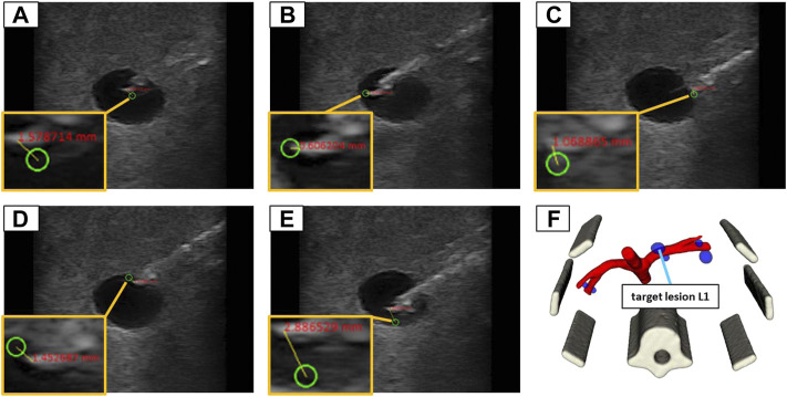 FIGURE 10