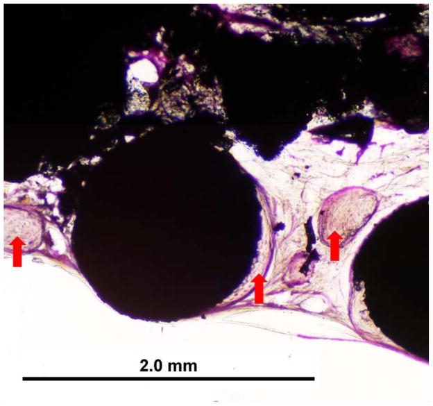 Fig. 10