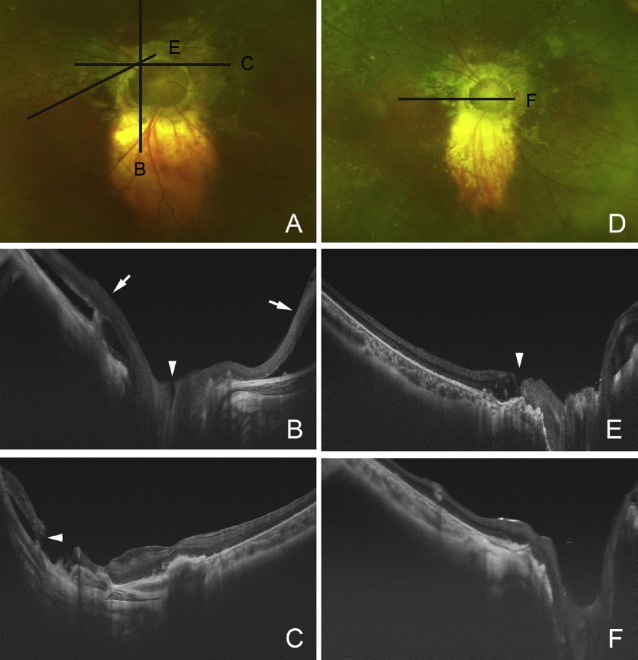 Fig. 7