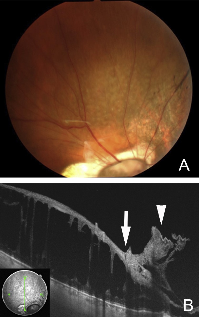 Fig. 5