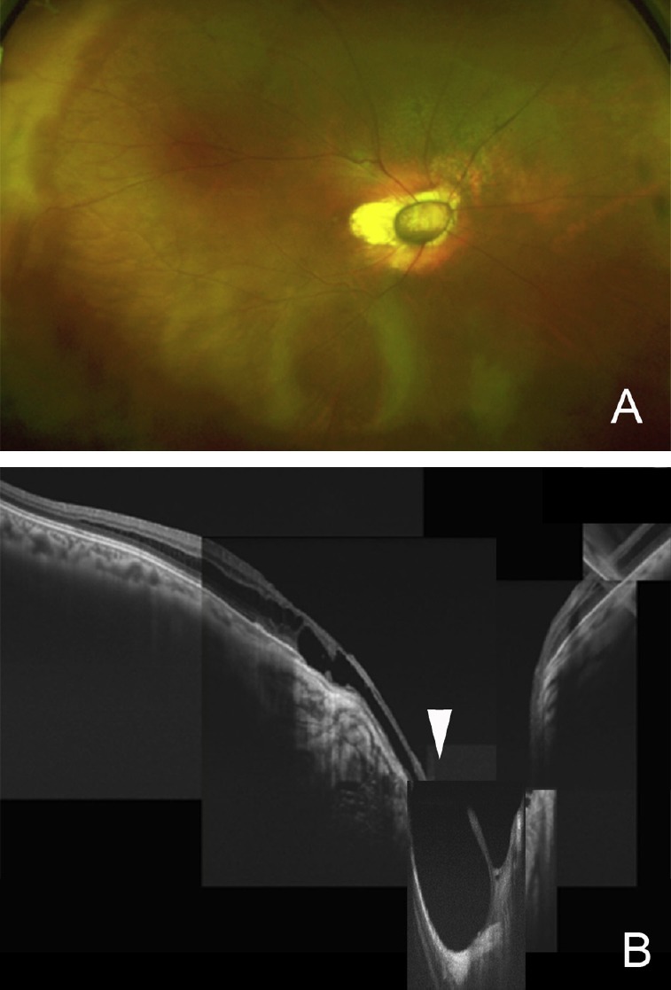 Fig. 6