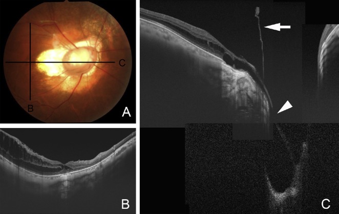 Fig. 4