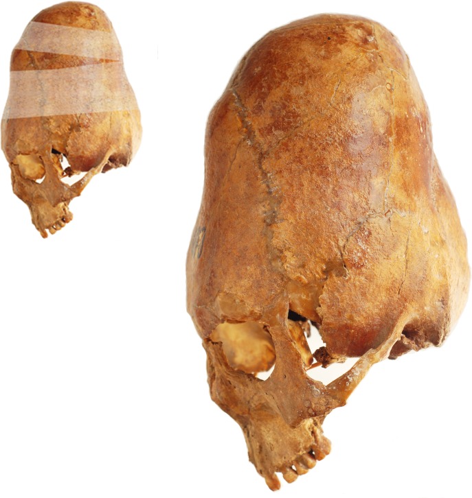 Fig 5