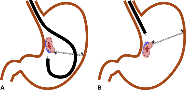 Figure 2