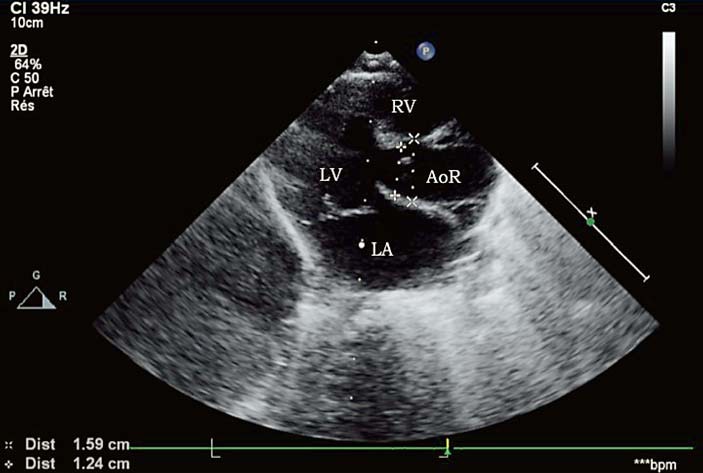 Fig. 2