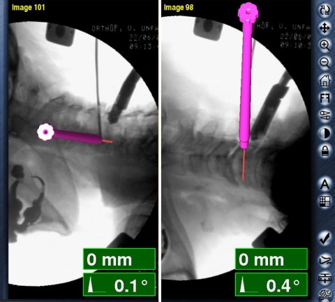 Fig. 3