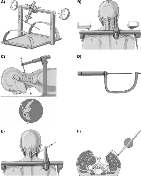 Fig. 2