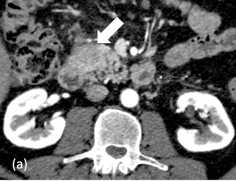 Figure 10.