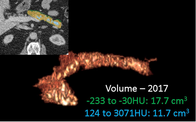 Figure 14.