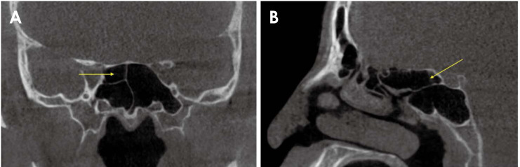 Fig. 4