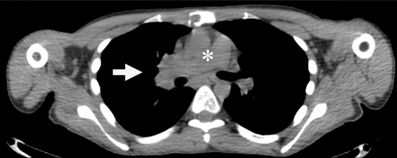 Figure 3b: