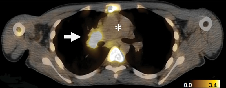 Figure 3c: