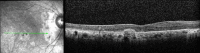Fig.10