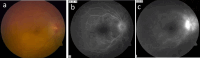 Fig. 9