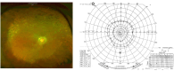 Fig. 11