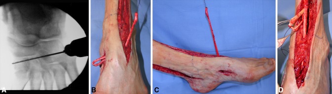 Fig. 5A–D