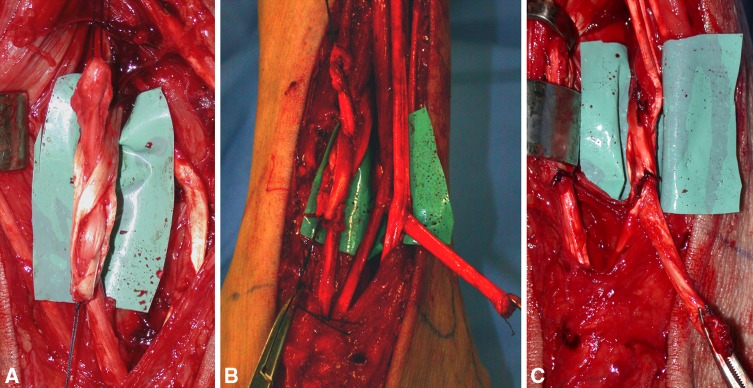 Fig. 6A–C