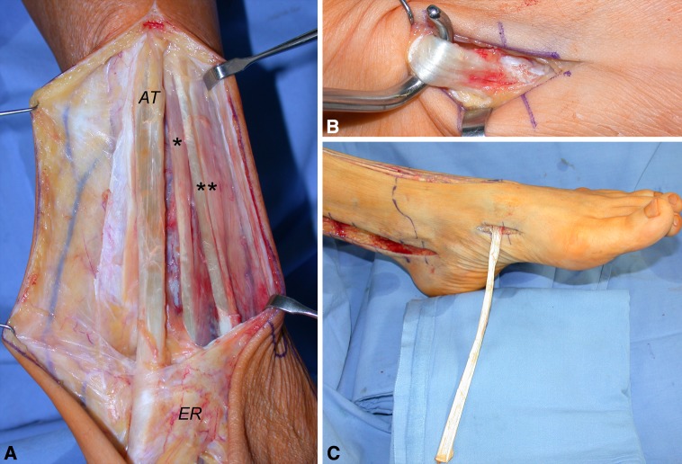 Fig. 2A–C