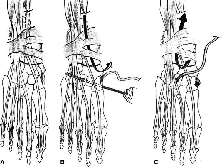 Fig. 3A–C