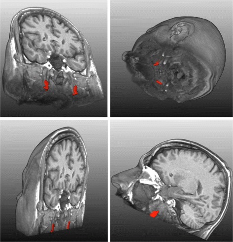 Fig. 9