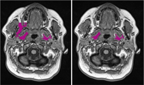 Fig. 8