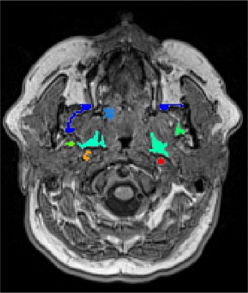 Fig. 4