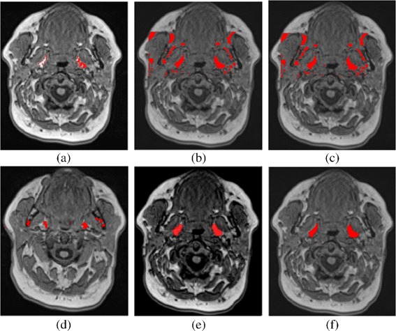 Fig. 11