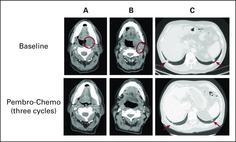 FIG 1.