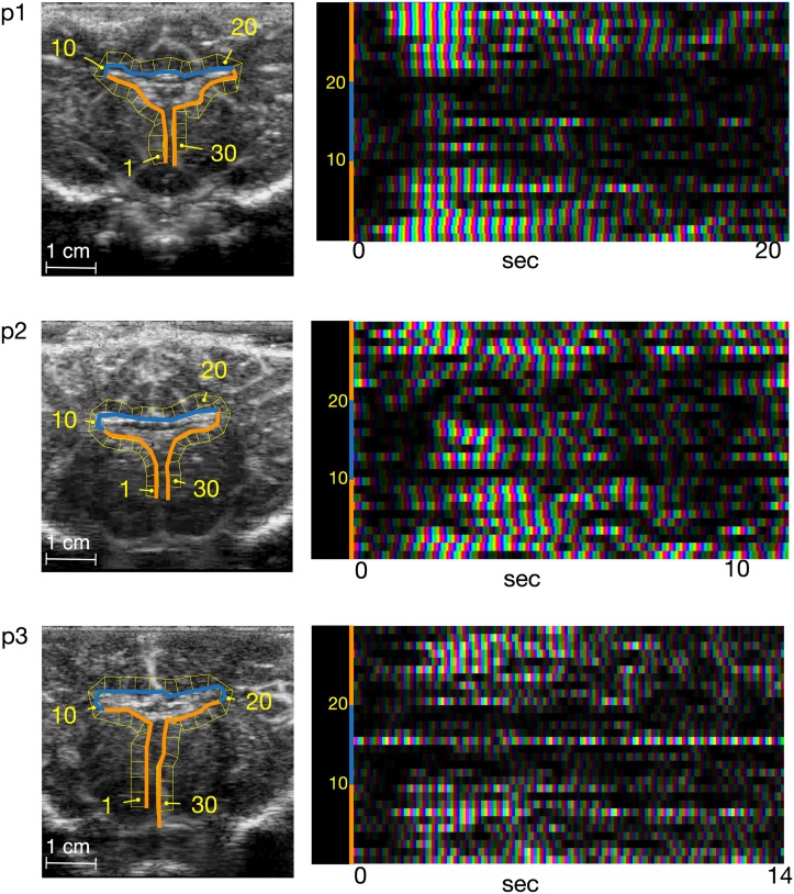 Fig 3