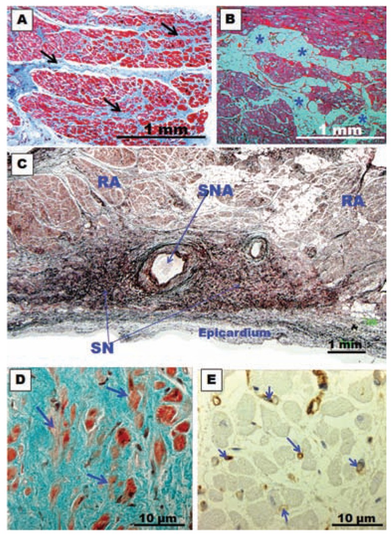 Fig. (12)