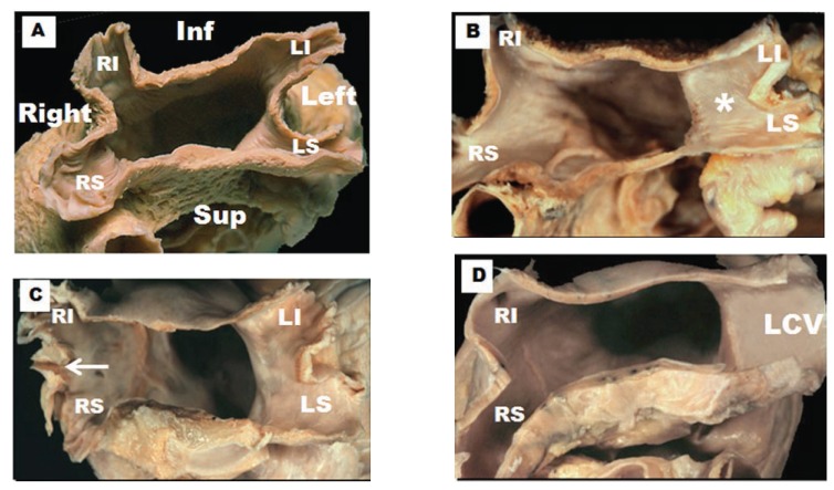 Fig. (2)