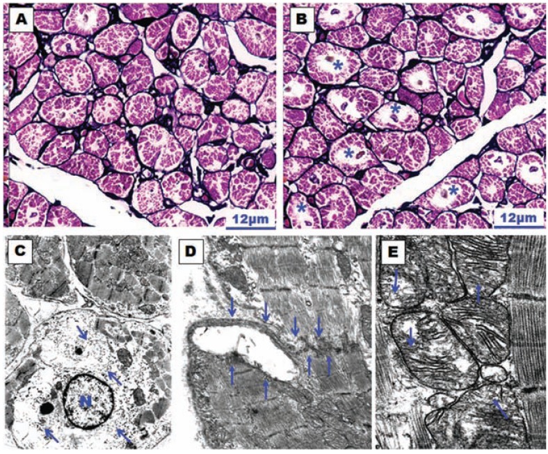 Fig. (11)