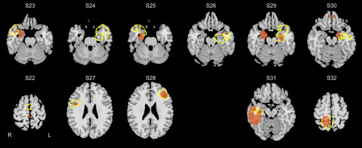 FIGURE 3