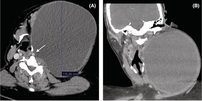 FIGURE 1