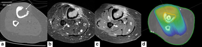 Fig. 1