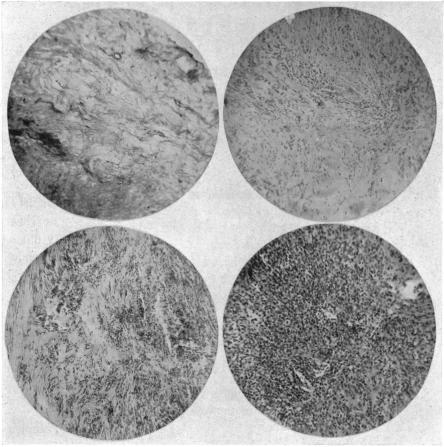 FIG. 11, 12, 13, 14.