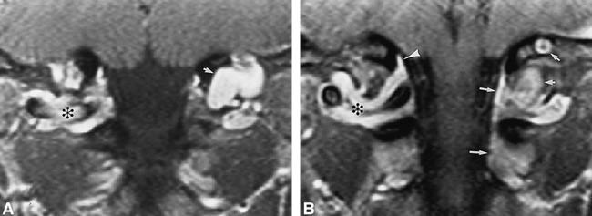 fig 2.