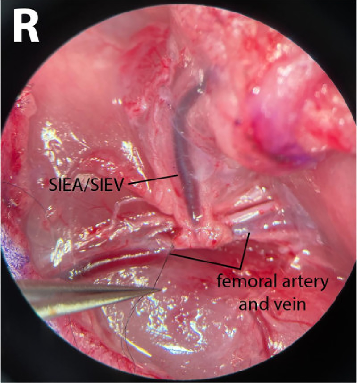 Figure 3: